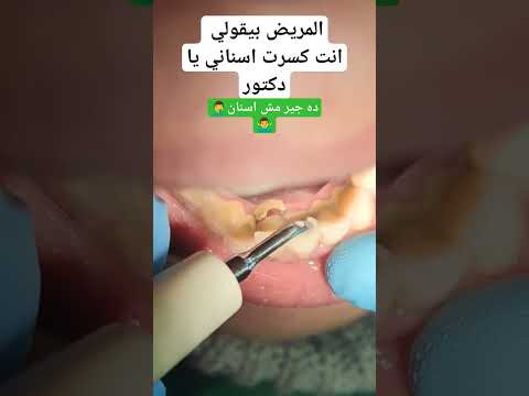 ما هي اضرار جير الاسنان    