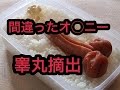 【閲覧注意】変なオ○ニーしてたせいでキンタマ摘出した話
