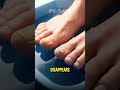 The Realities of Dermal Pathogens and Interstitial Pedal Edema 🧪