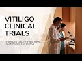 Vitiligo Clinical Trials: Why It Takes 10+ Years to Develop New Treatments