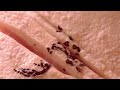 Beginning of video