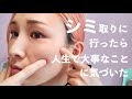 シミ取りに行ったら人生で大事なことに気づいた