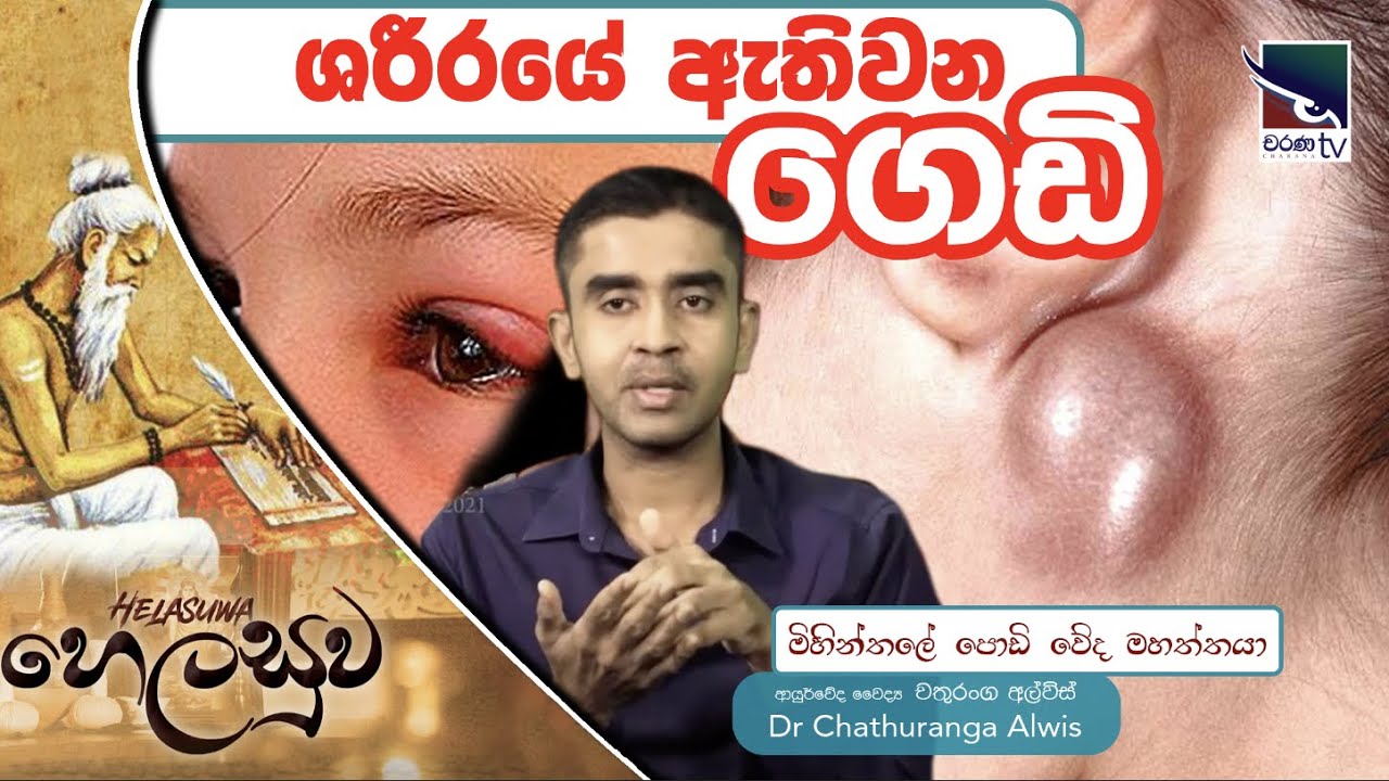 ශරීරයේ ඇතිවන ගෙඩි නිසා පිළිකා‌ ඇතිවීමට අවදානමක් තියෙනවද ?