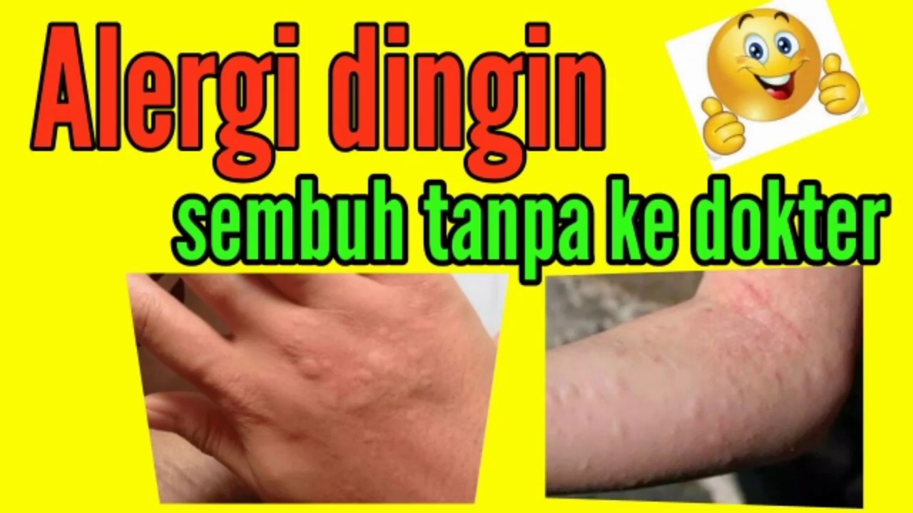 Alergi dingin menyiksa ! Lakukan cara ini,Wowww liat hasilnya