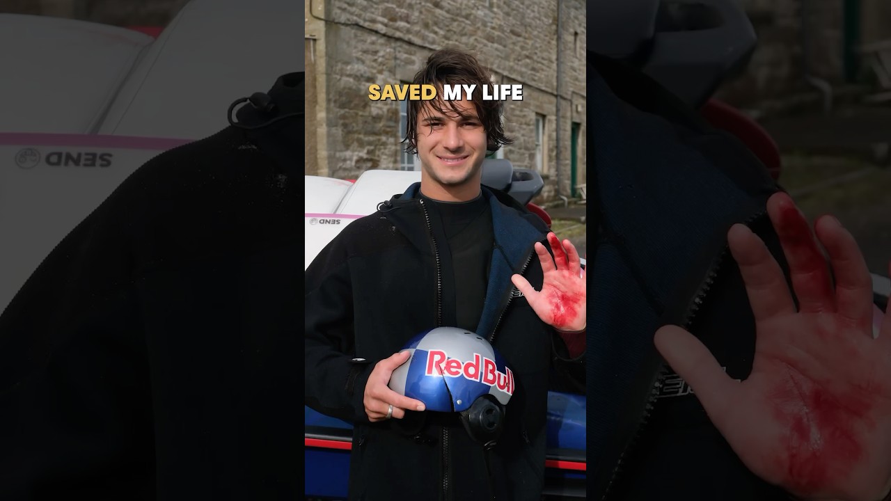 His helmet saved his life!