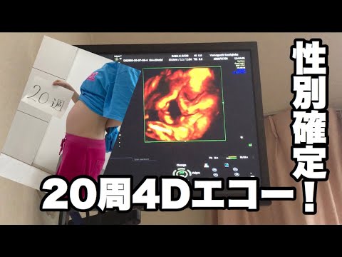 妊娠２０週４ｄエコーで性別確定 妊娠 赤ちゃん Baby 経過報告 孫 妊婦 Youtube