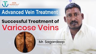 Happy patient with successful varicose vein treatment | Avis Hospitals