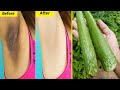 How To Whiten Dark Underarms Instantly Permanently | 100% Works At Home