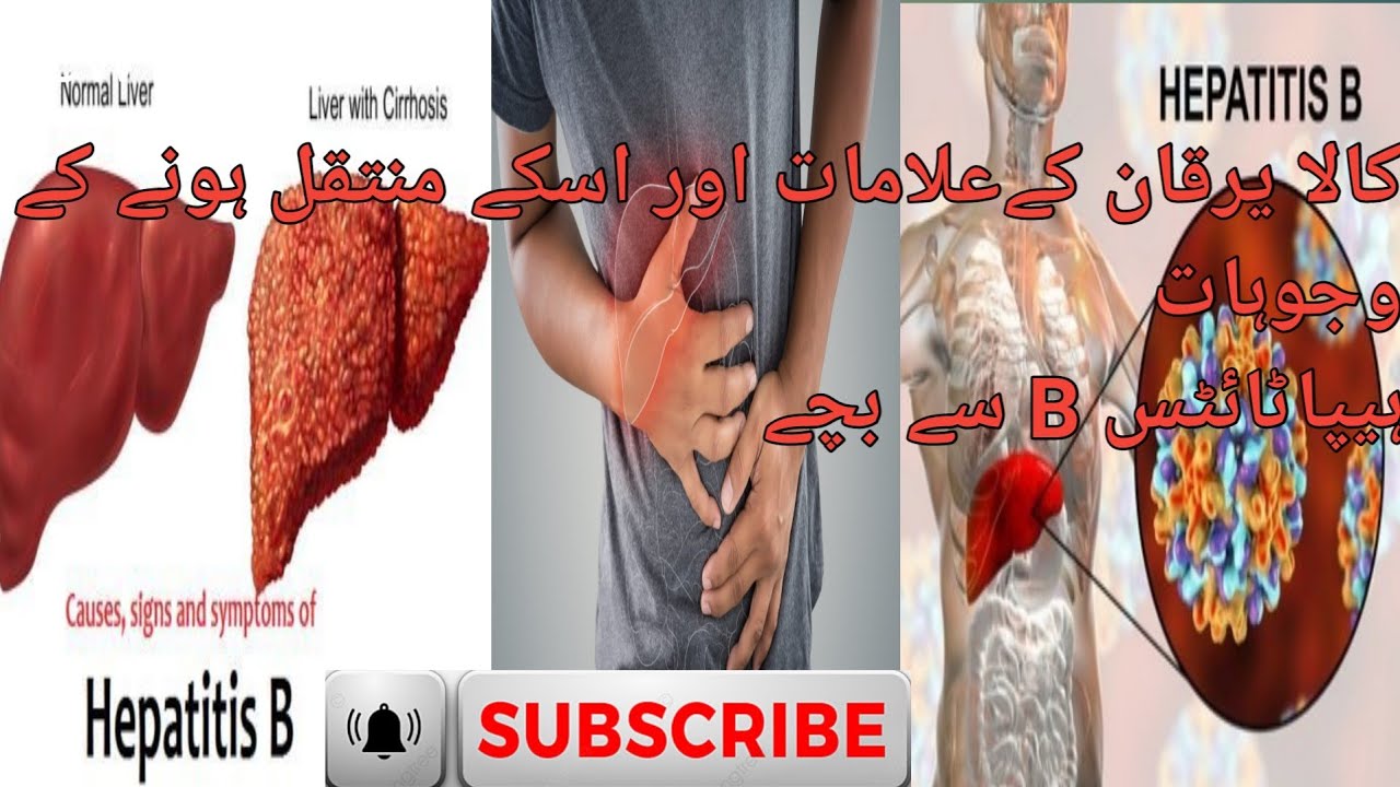 hepatitis-b-and-its-symptoms-causing-prevention-powerofkindness-youtube