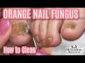 👣Pedicure for Men How to Clean Orange Nail Fungus Off Toenails👣