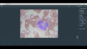 Datature Portal Takehome