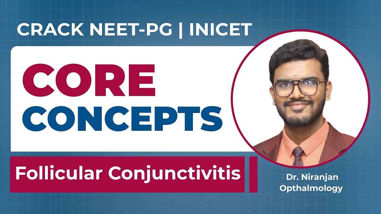 Medico Core Concepts: Follicular Conjunctivitis, Dr Niranjan