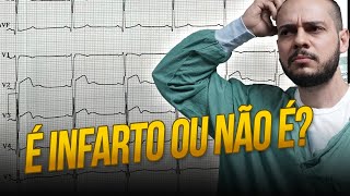 É Possível Infartar Aos 22 Anos? Descubra No Vídeo