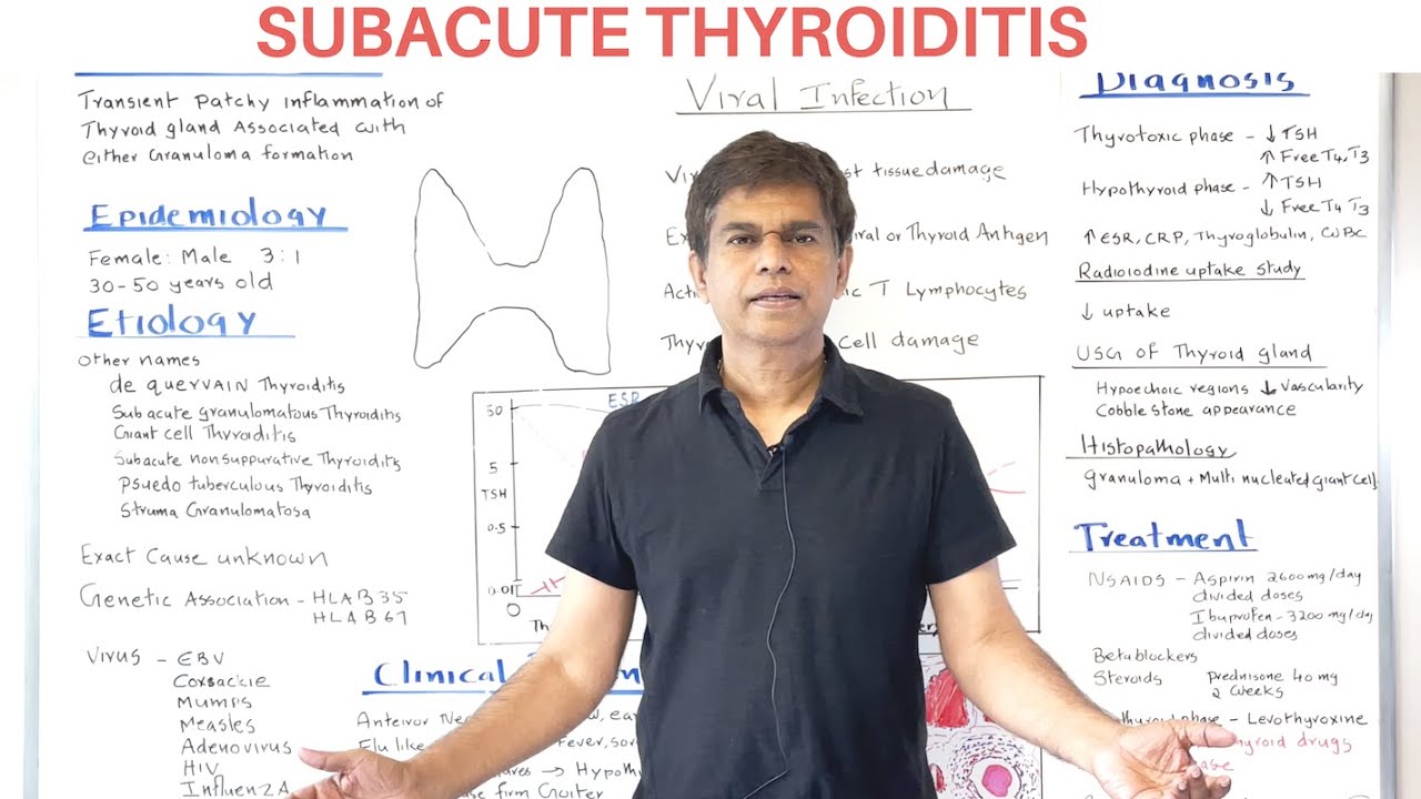 SUBACUTE THYROIDITIS - AN OVERVIEW - By Pramil Cheriyath MD