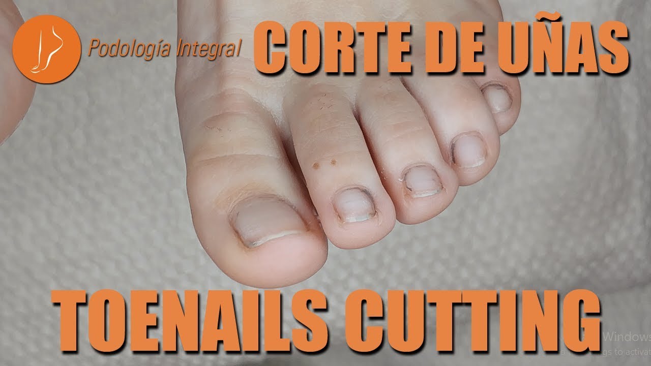 Toenails cutting [Podología Integral] Integral Podology YouTube