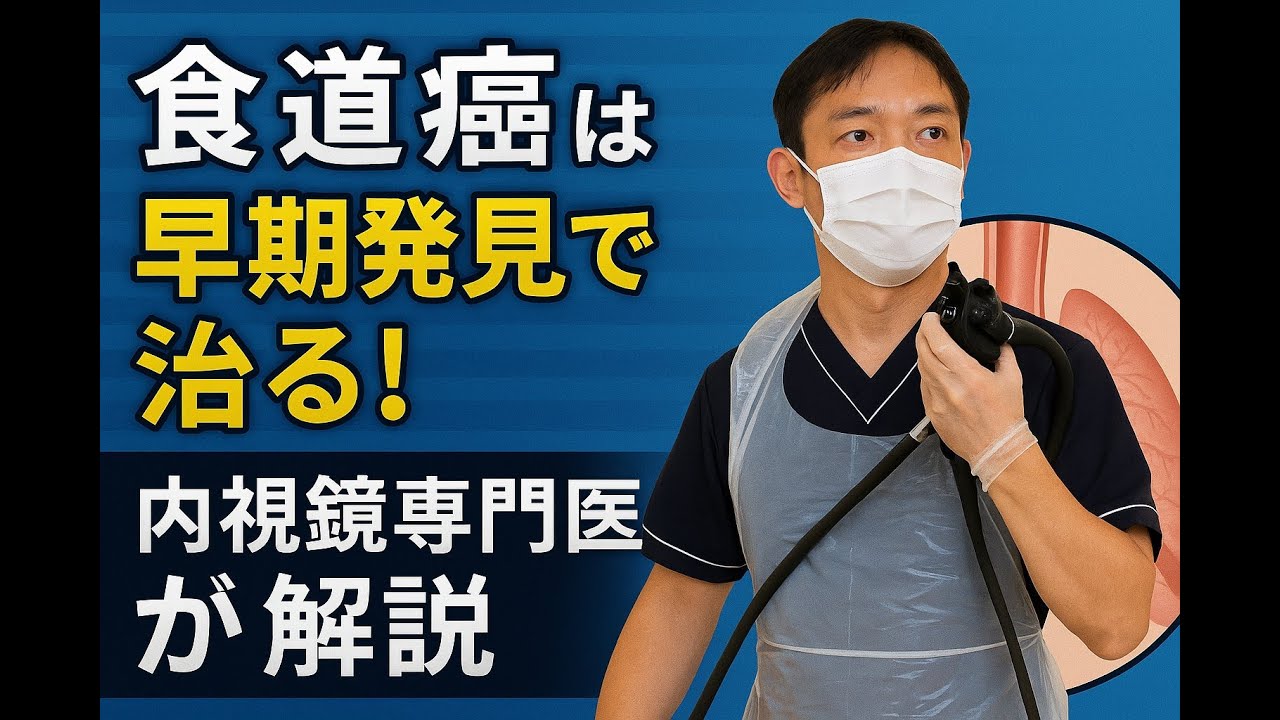 食道ガンは早期発見すれば、完治できる！　内視鏡専門医が解説