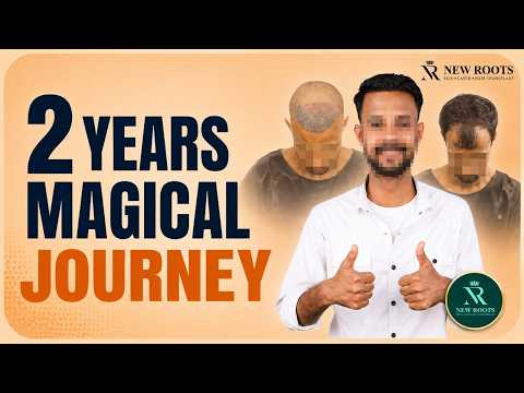 Grade 3 Baldness to Long-Lasting Results 😱 | Hair Transplant in Bangalore | New Roots | Bengaluru