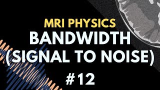 How Bandwidth Affects Signal to Noise Ratio (SNR) in MRI | MRI Physics Course #12