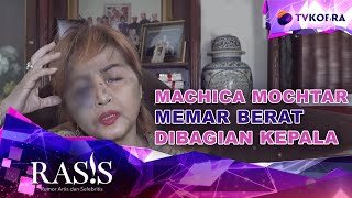 After Accident, Machica Mochtar Often Complains of Nausea and Headaches