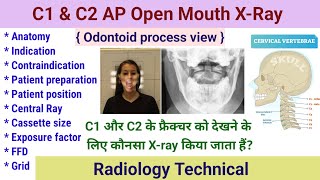 Cervical spine Radiography # C1 & C2 AP Open mouth x-ray # Odontoid Process View # Patient position