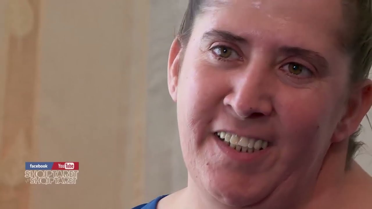 Shqiptaret per Shqiptaret -Admiri humbi shikimin kur ishte 7 vjeç.Ai ka një peng qe e mundon në jetë