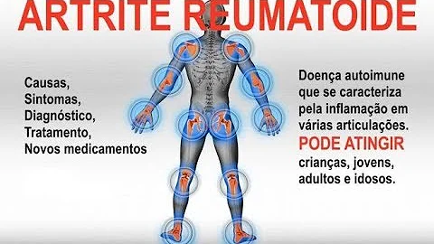O que fazer para passar a dor no maxilar?