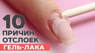 10 causes of gel polish LIFTINGS | How to deal with them?