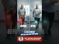 Is Recurring Knee Pain Slowing You Down? - Heren is What Your Need to Know | Dr. Manuj Wadhwa