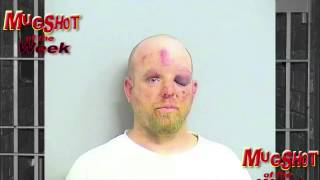 Mugshot  Of The Week - Two Face