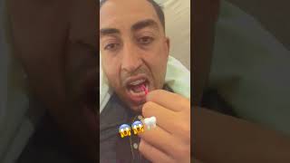 When Using Floss Goes Wrong…#shorts 😱