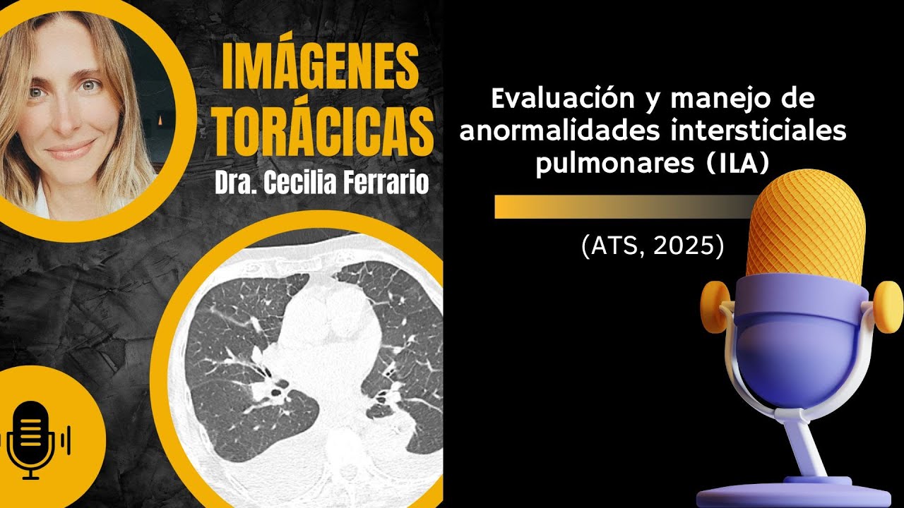 ¿Qué son las ILAs y por qué importan? Actualización ATS 2025