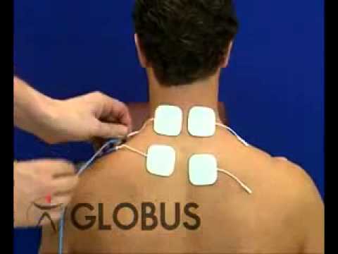 colocacion-de-electrodos-electroestimulacion-en-cervicales-youtube
