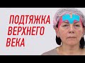 ✅ ПОДТЯЖКА ВЕРХНЕГО ВЕКА | Валентин Гайт | Учебный центр BBALANCE