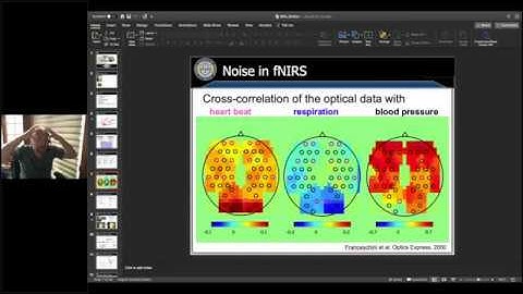 Motion Artifact and Corrections in  NIRS Toolbox (Brain AnalyzIR) with Dr.  Ted Huppert