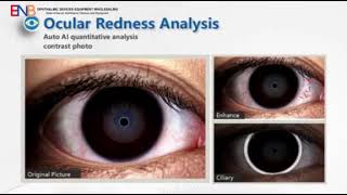 Ocular Surface Analyzer