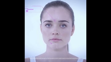 Trẻ hóa xóa nhăn vùng mắt, trán, khóe miệng để tự tin đón tết