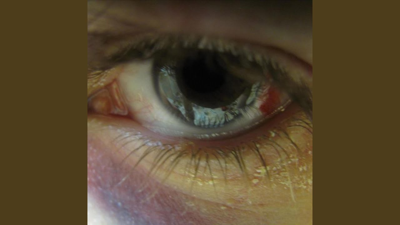 Watch Epilepsy on YouTube Watch Epilepsy on YouTube