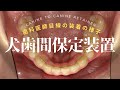 犬歯間保定装置の装着の様子🦷