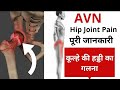 Avn of hip joint          drdushyant 