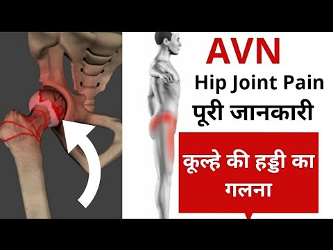 वीडियो: निम्नलिखित में से कौन सी कूल्हे की हड्डी बेहतर है?