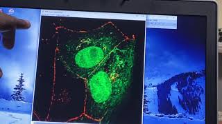 Confocal Image Processing Analysis Using ImageJ