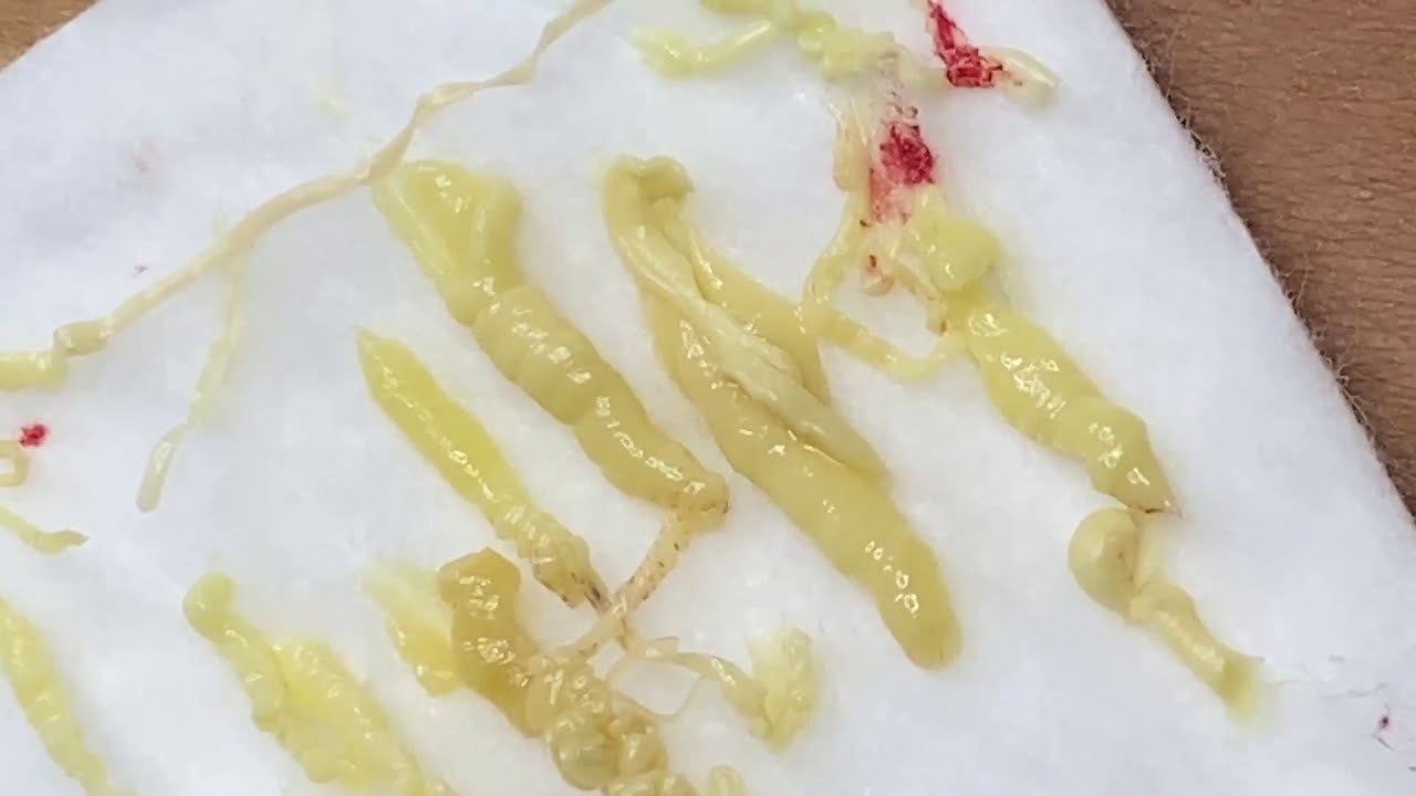 Relax Every Day With Sac Dep Spa 0170 YouTube