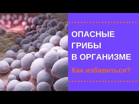 Избавиться от грибов в организме. Нужно 30 дней!