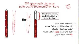 سرعة التثفل والكريات البيضاء  (Erythrocyte Sedimentation Rate (ESR