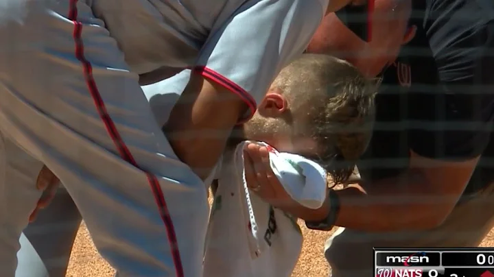 Nationals pitcher Austin Voth hit in face