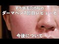 【ダーマペン】7回目のダーマペンレビュー&今後について (金額、効果、ダウンタイム、経過について)