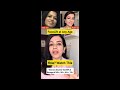 Facelift at Any Age | Watch how | Jywas Beauty