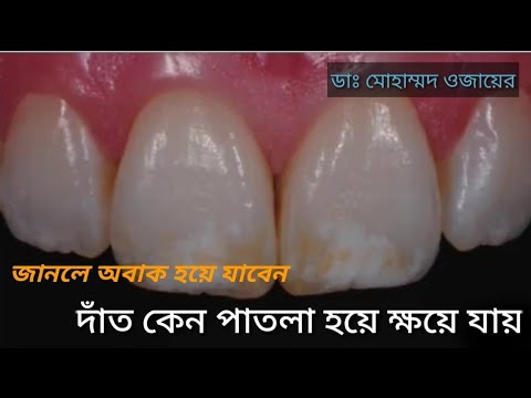 Video: Tooth Enamel Malformation Sa Mga Pusa