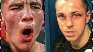 Oscar Valdez's broken jaw !!! vs Scott Quigg's broken nose !!!