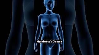 Unexplained Weight Gain? Check Your Thyroid